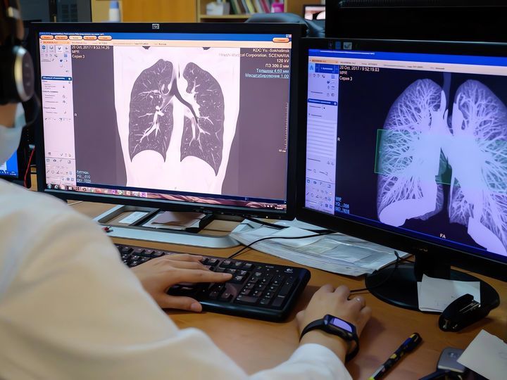 Sciberia — software for medical image analysis in radiology